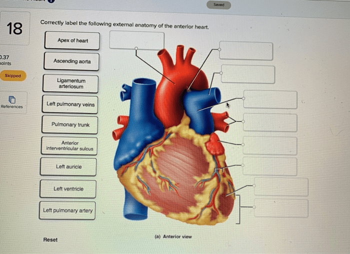 Correctly label the following external anatomy of the posterior heart